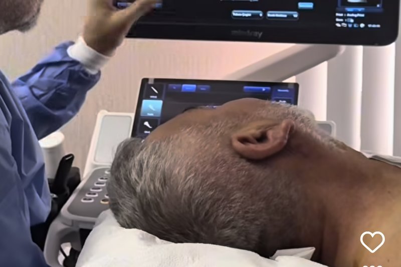 Paratiroid Adenomu ve Ameliyatsız Termal Ablasyon Tedavisi Uygulama ve İyileşme Süreci - Prof. Dr. Aykut Recep Aktaş